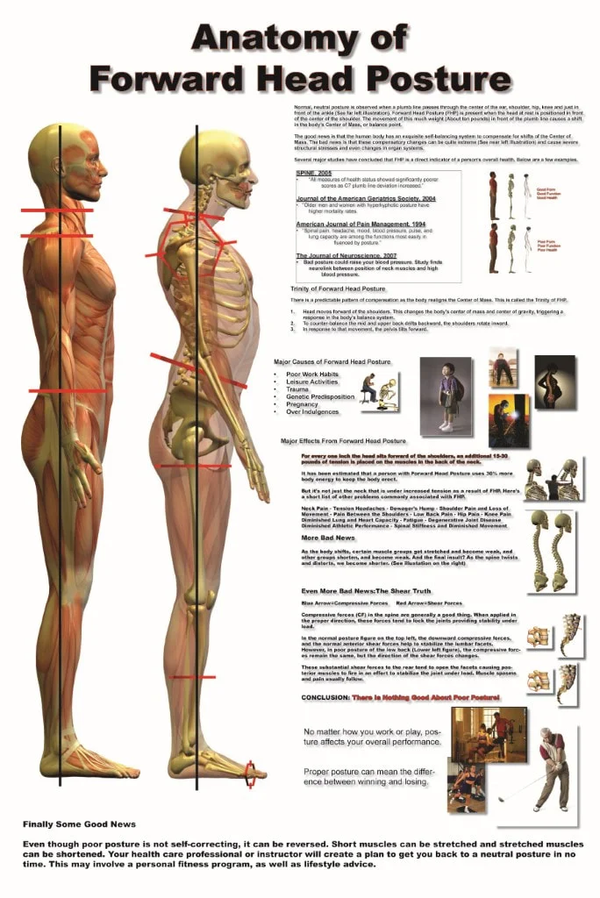 Forward Position Poster Anatomy of Forward Head Posture Poster โ Ventura Designs