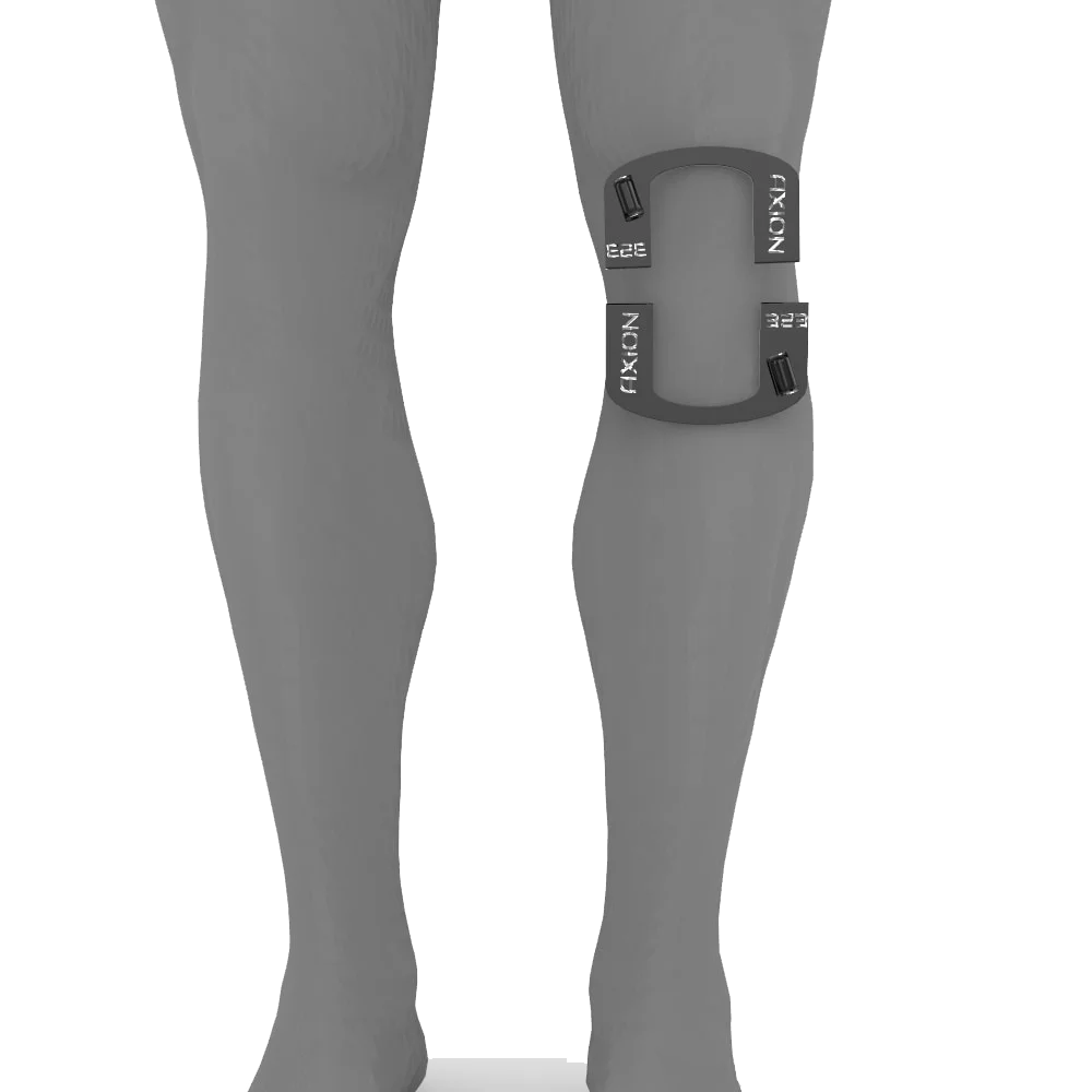 Knee Electrodes
