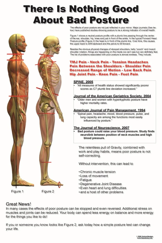 Nothing Good About Poor Posture