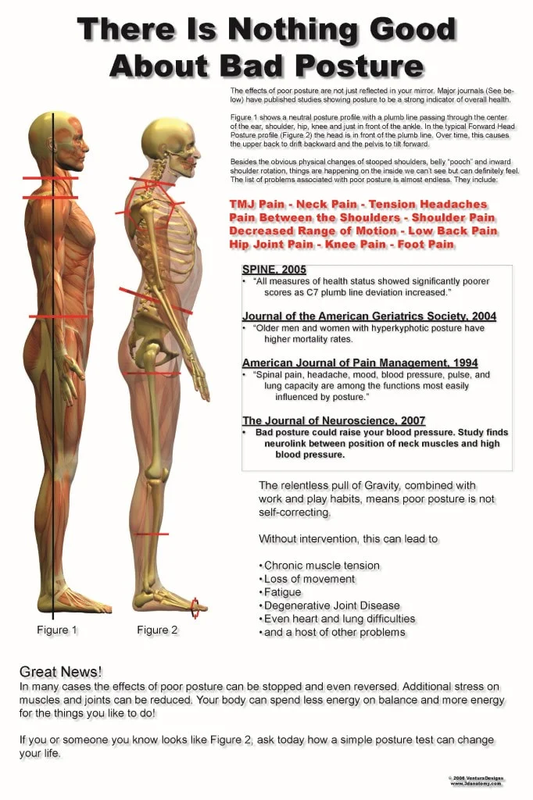 Nothing Good About Poor Posture