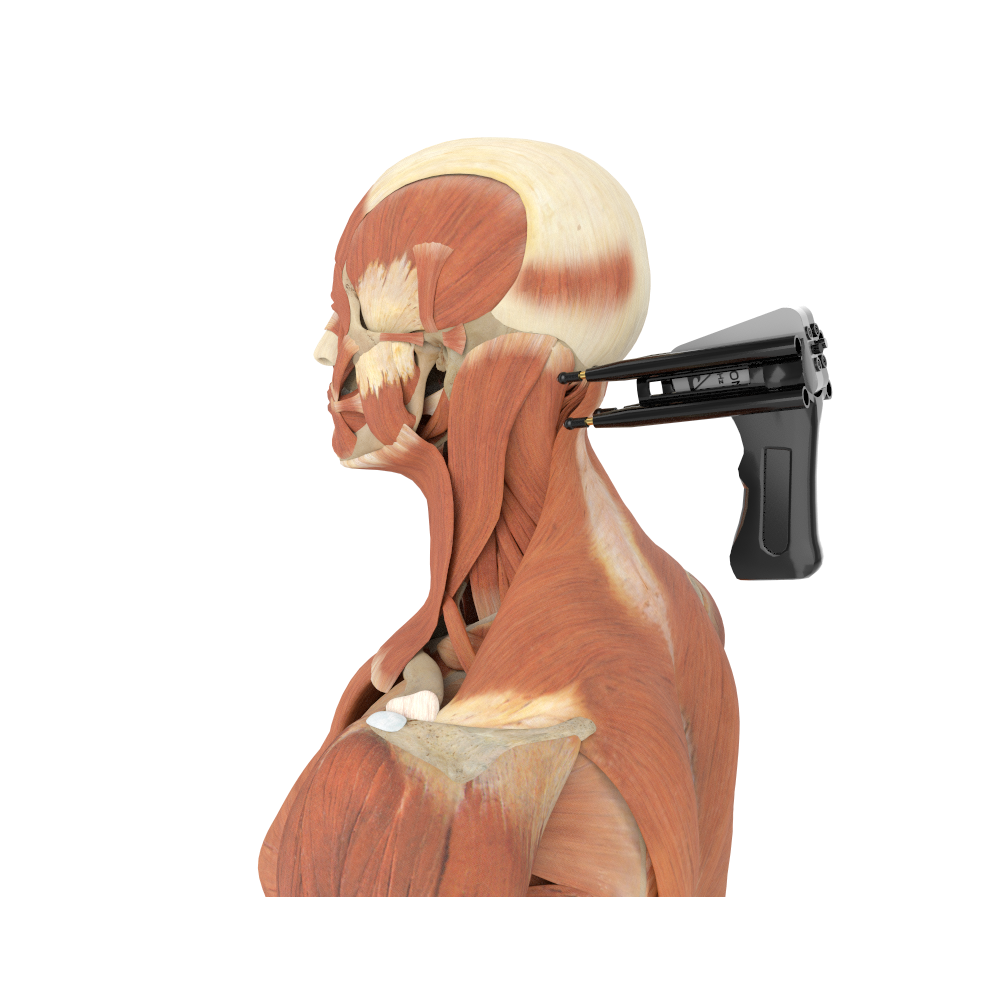 SpineMaster® iPROBE